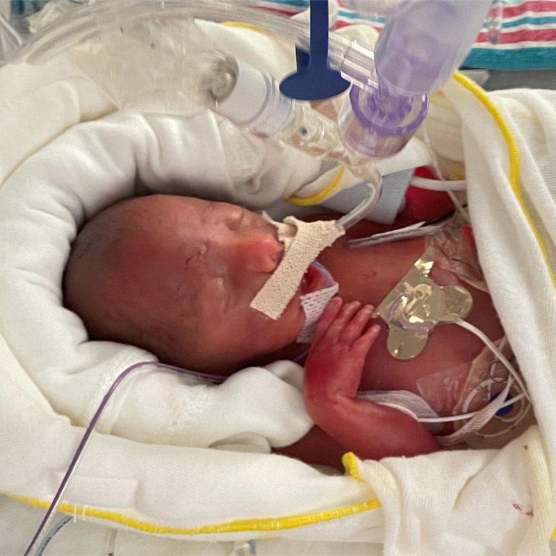 Severin Anthony Lee - Photo 2